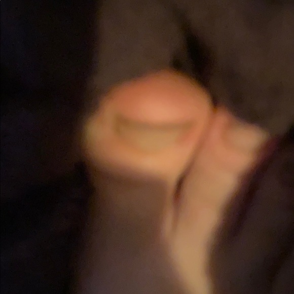 Toe